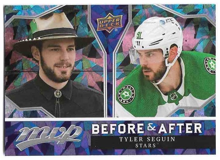 Before and After TYLER SEGUIN 21-22 UD MVP